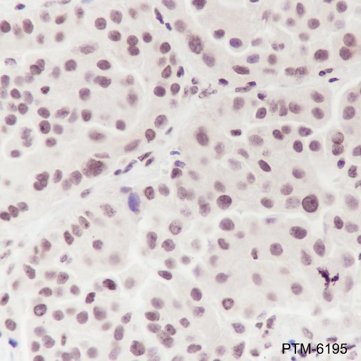 Anti-Ataxin-3 Rabbit mAb