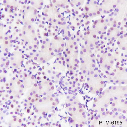 Anti-Ataxin-3 Rabbit mAb