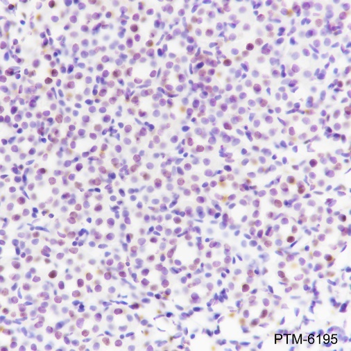 Anti-Ataxin-3 Rabbit mAb