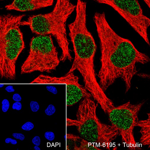 Anti-Ataxin-3 Rabbit mAb