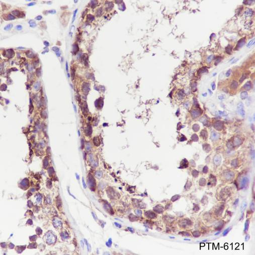 Anti-LysRS Rabbit mAb