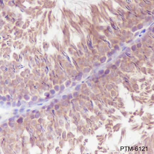 Anti-LysRS Rabbit mAb