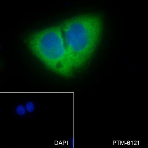 Anti-LysRS Rabbit mAb