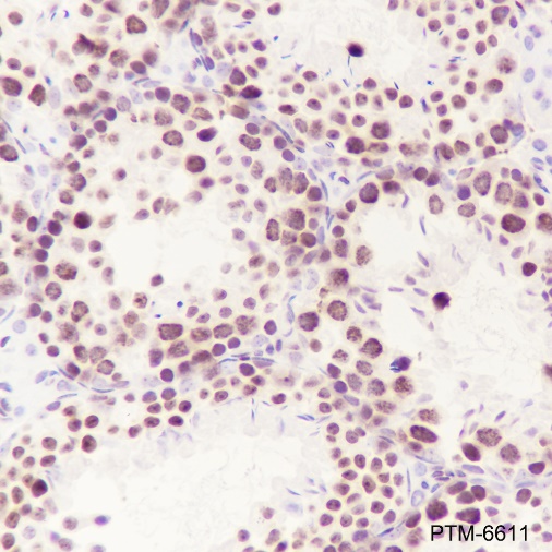 Anti-HMGB2 Rabbit mAb