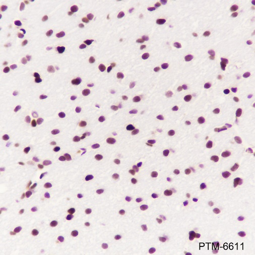 Anti-HMGB2 Rabbit mAb