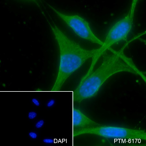 Anti-IMPDH2 Rabbit mAb