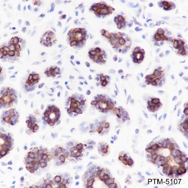 Anti-Keratin 8 Mouse mAb