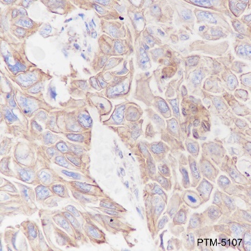 Anti-Keratin 8 Mouse mAb