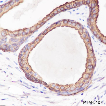 Anti-Keratin 8 Mouse mAb