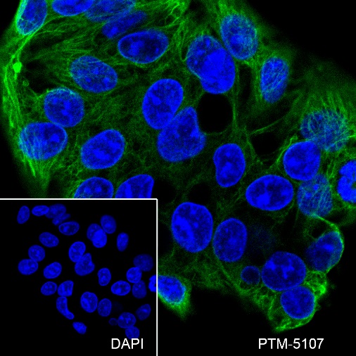 Anti-Keratin 8 Mouse mAb