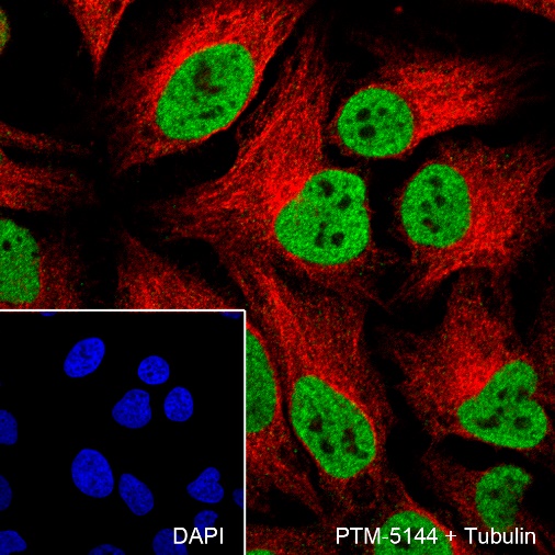 Anti-SMARCA5 Mouse mAb