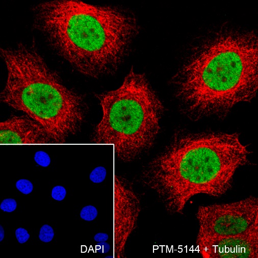 Anti-SMARCA5 Mouse mAb