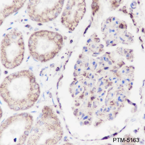 Anti-ATP5A1 Mouse mAb
