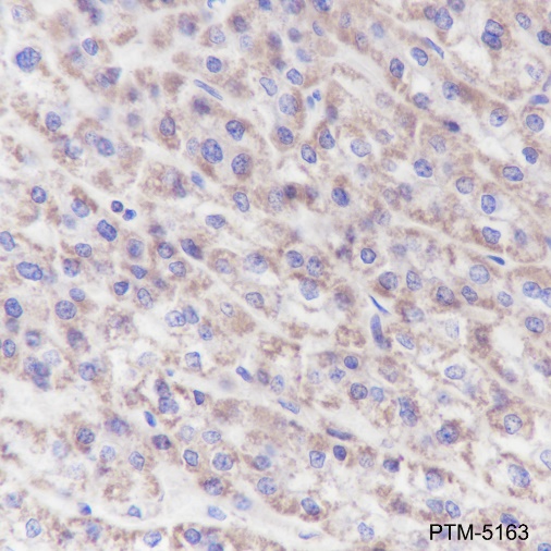 Anti-ATP5A1 Mouse mAb