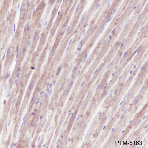 Anti-ATP5A1 Mouse mAb