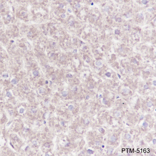 Anti-ATP5A1 Mouse mAb