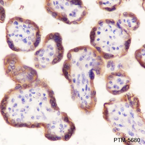 Anti-Laminin beta 1 Rabbit mAb