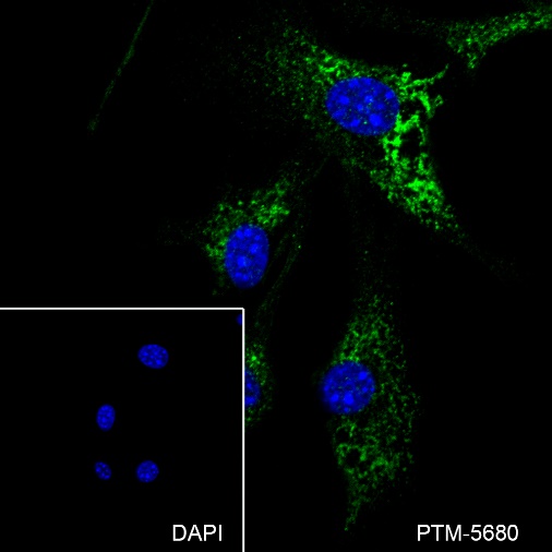 Anti-Laminin beta 1 Rabbit mAb
