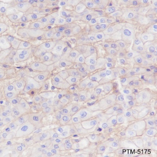 Anti-CD147 Mouse mAb