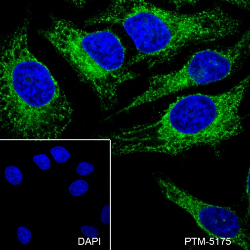 Anti-CD147 Mouse mAb