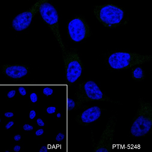 Anti-CD3 epsilon Mouse mAb
