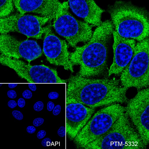 Anti-Bcl-2 Mouse mAb