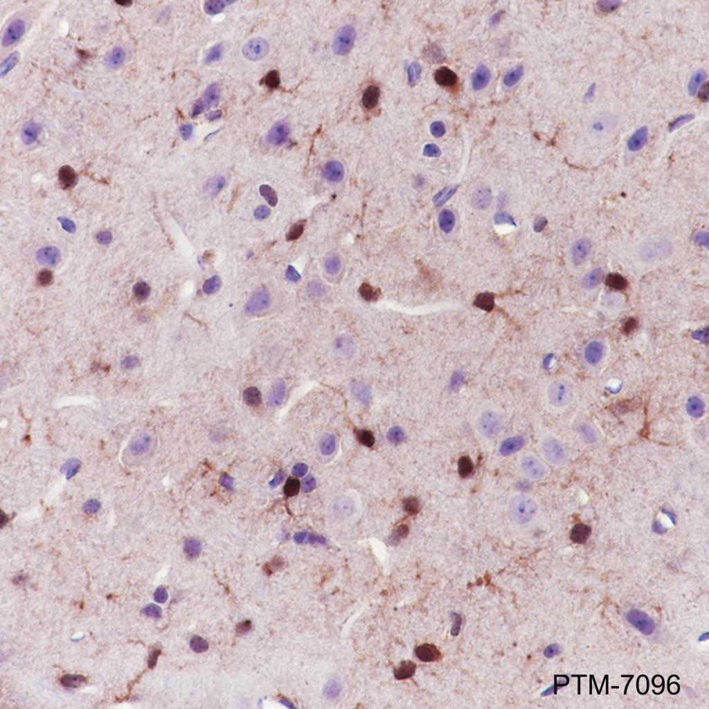 Anti-S100B Rabbit pAb