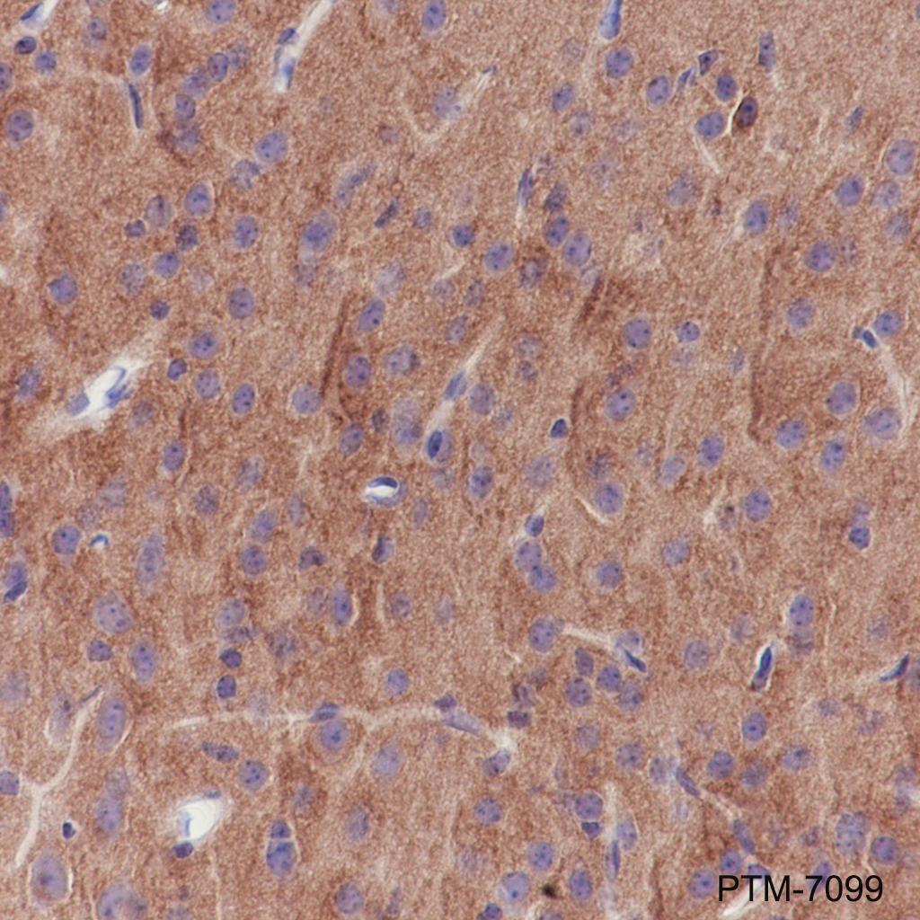 Anti-Pan-Trk Rabbit mAb