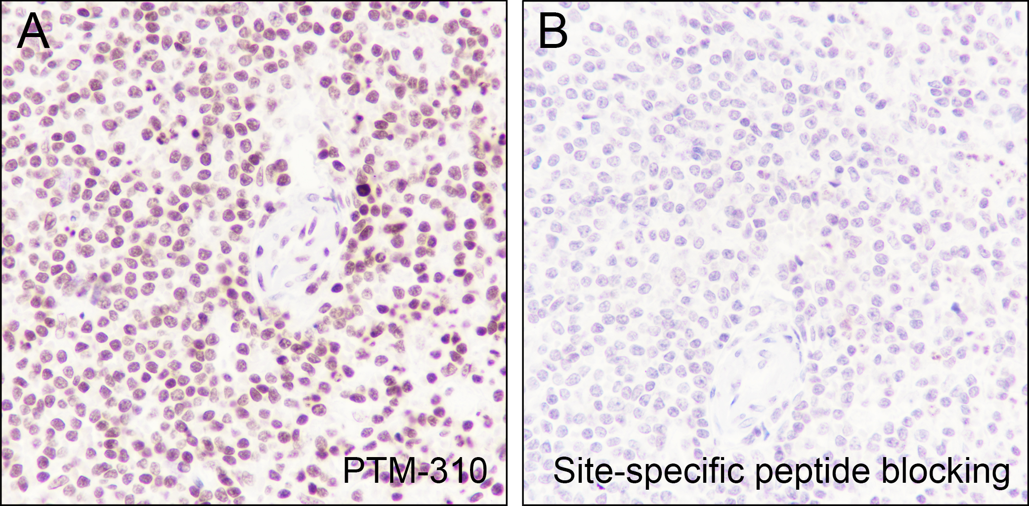 Anti-Butyryl-Histone H4 (Lys5) Mouse mAb