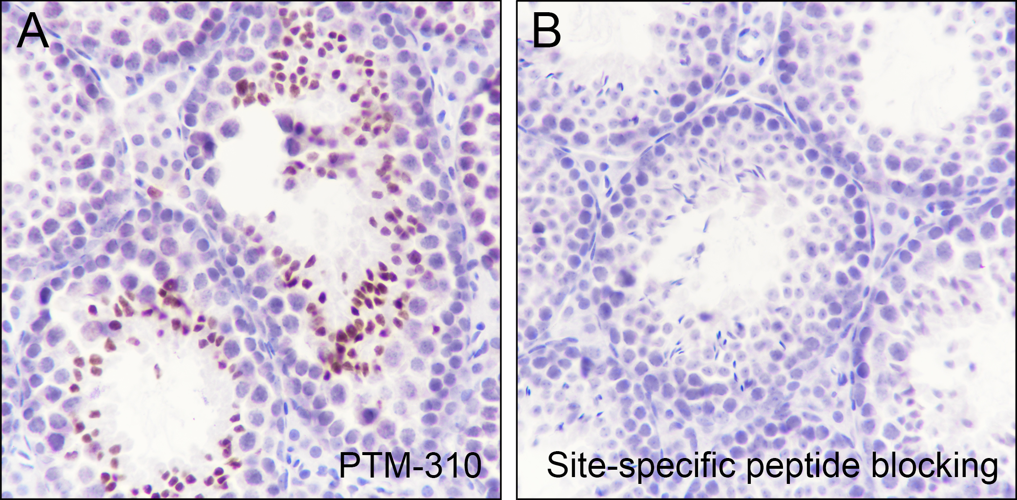 Anti-Butyryl-Histone H4 (Lys5) Mouse mAb