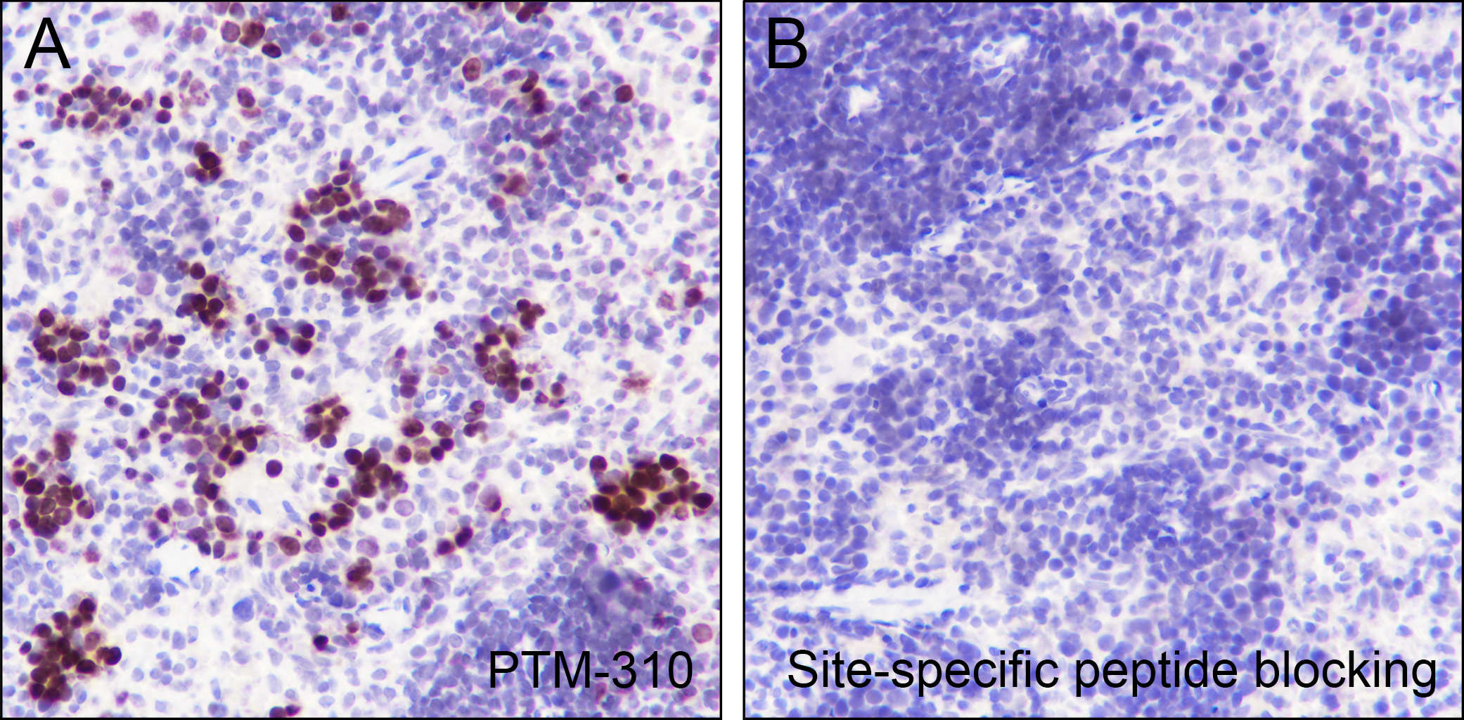 Anti-Butyryl-Histone H4 (Lys5) Mouse mAb