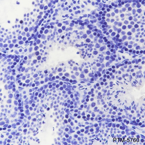 Anti-Keratin 1 Rabbit pAb