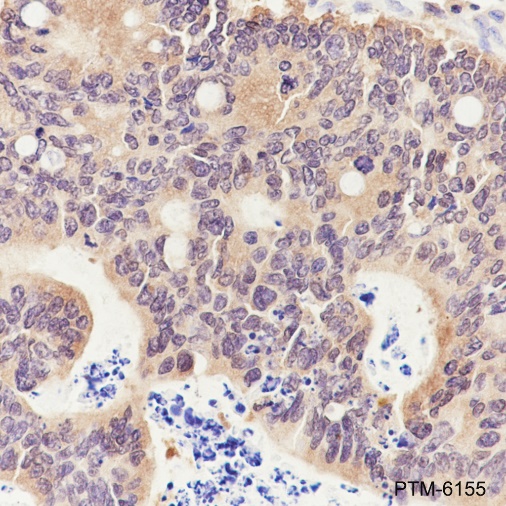 Anti-PPM1A Rabbit mAb