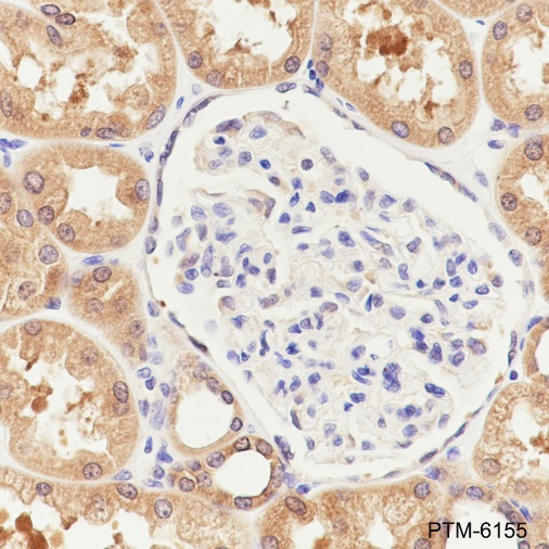 Anti-PPM1A Rabbit mAb