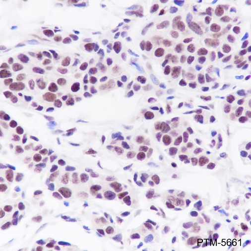 Anti-TFEB Rabbit mAb