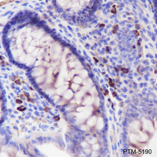 Anti-Lambda Light Chain Rabbit mAb