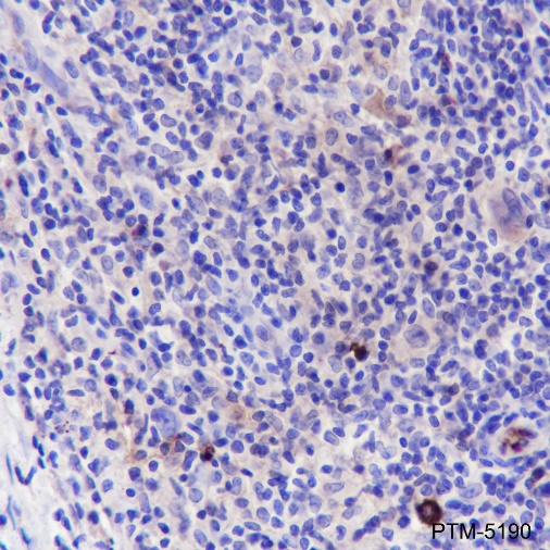Anti-Lambda Light Chain Rabbit mAb