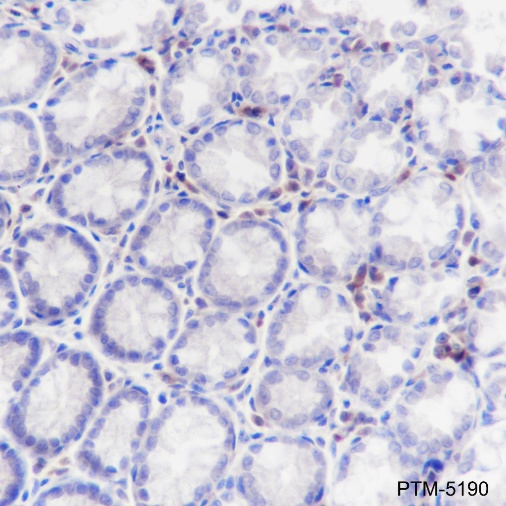 Anti-Lambda Light Chain Rabbit mAb