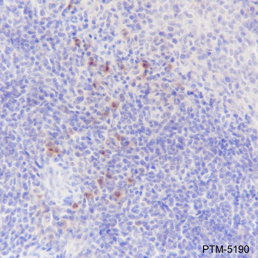 Anti-Lambda Light Chain Rabbit mAb
