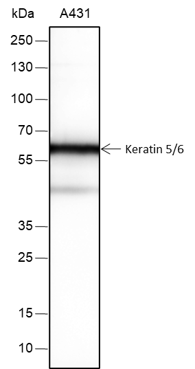 Anti-Keratin 5/6 Rabbit mAb