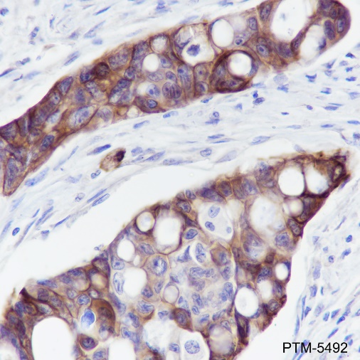 Anti-Keratin 5/6 Rabbit mAb
