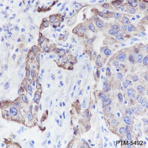 Anti-Keratin 5/6 Rabbit mAb