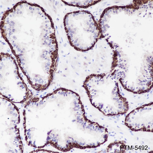Anti-Keratin 5/6 Rabbit mAb