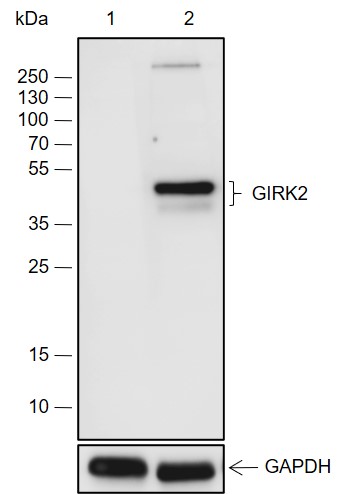 Anti-GIRK2 Rabbit mAb