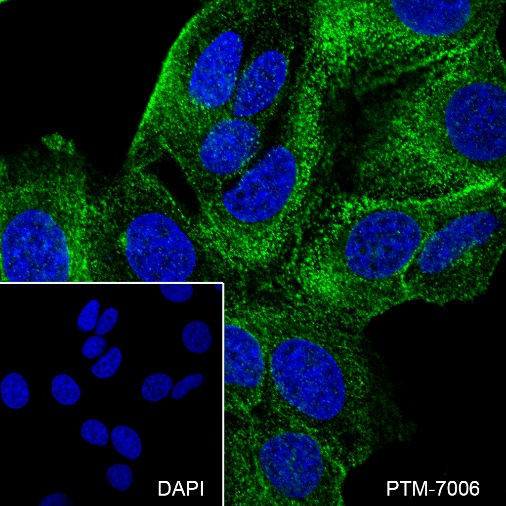 Anti-PACSIN3 Rabbit mAb