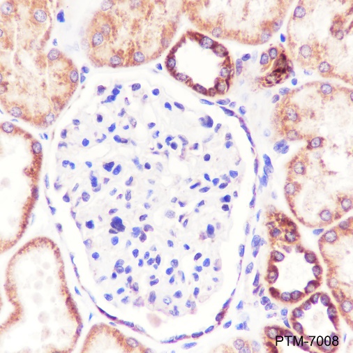 Anti-Bcl-XL Rabbit mAb