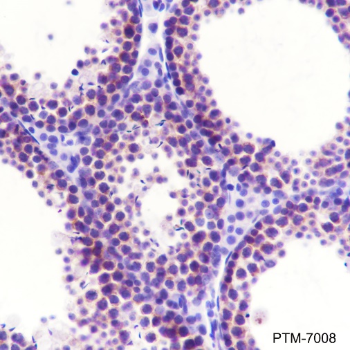 Anti-Bcl-XL Rabbit mAb