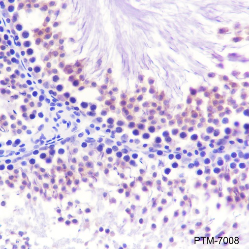 Anti-Bcl-XL Rabbit mAb