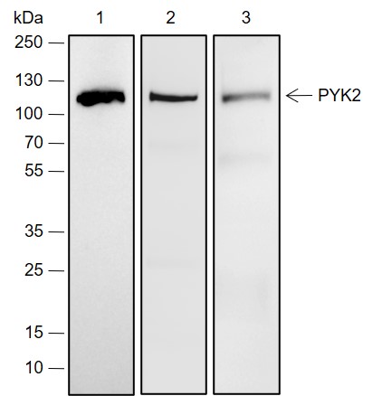 Anti-PYK2 Rabbit mAb