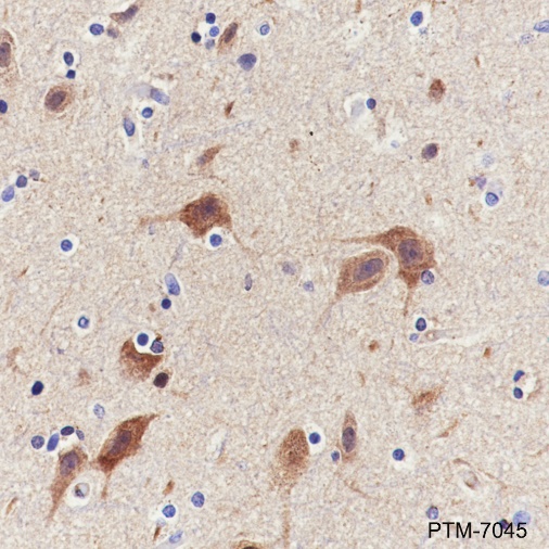 Anti-PYK2 Rabbit mAb